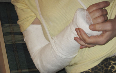 Оздоровительный лагерь в Волжском выплатит компенсацию подростку за сломанную руку