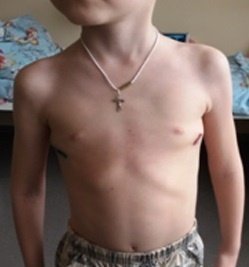 Хирурги больницы №7 Волгограда провели уникальную операцию